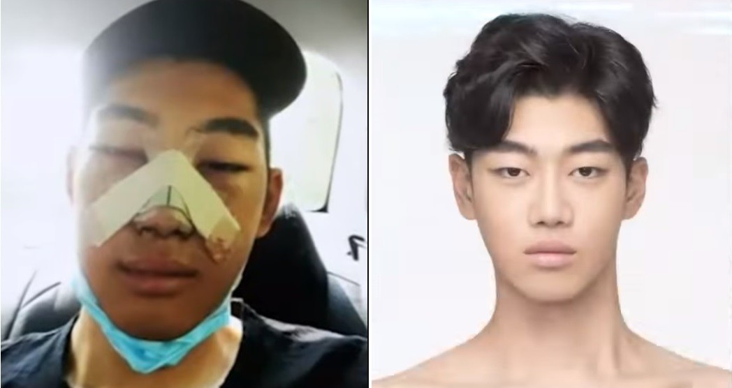 More South Korean Men Are Having Plastic Surgery to Look ‘Pretty’ Like K-Drama Actors