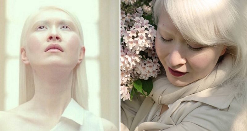 Meet The World’s First Albino Fashion Model From Hong Kong
