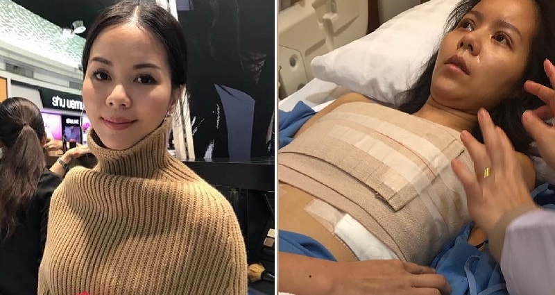 Thai Pop Star Sues Korean Plastic Surgery Clinic for $600,000 Over Boob Job That Almost Killed Her