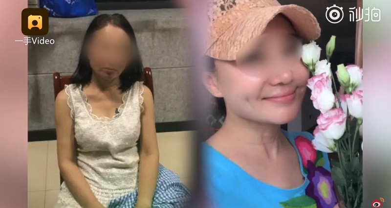 Elderly Woman Gets Plastic Surgery to Look 20 to Escape Creditors