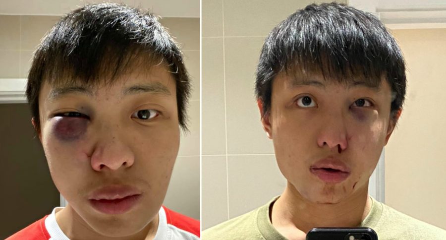 Teen Pleads Guilty in Coronavirus-Related Attack on Singaporean Student in London