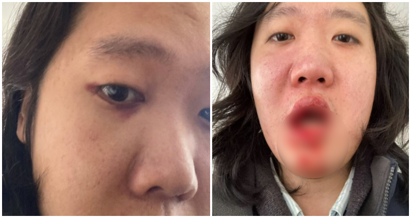 Man Sucker Punched, Loses Tooth in Random Attack in Washington DC