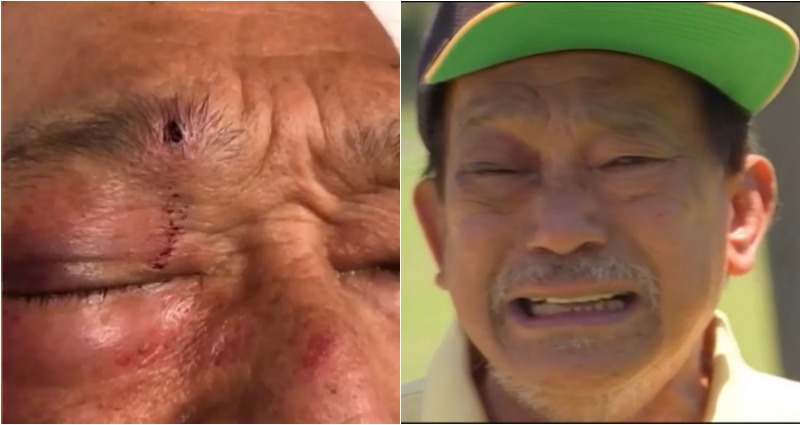Elderly Filipino Man Doesn’t ‘Want to Go Out’ After Being Attacked While Walking in California Park