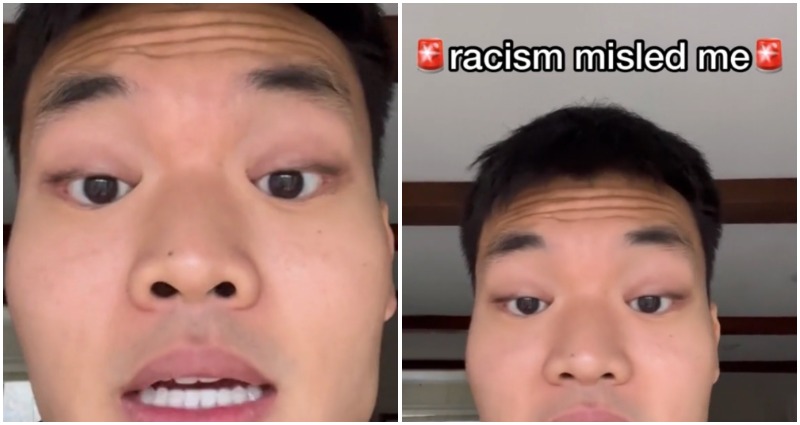 Racism or medical condition?: TikToker finds explanation for why he can’t open his eyes wider