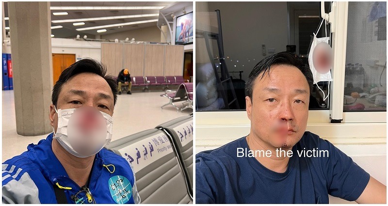 Hong Kong actor Wong He suffers horrifying nosebleed after PCR test in Taiwan