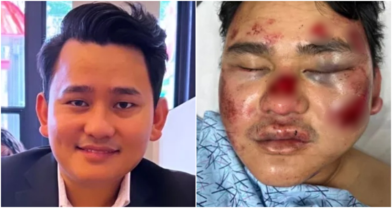 Nepali man brutally attacked from behind and left unconscious while grabbing food in Oakland