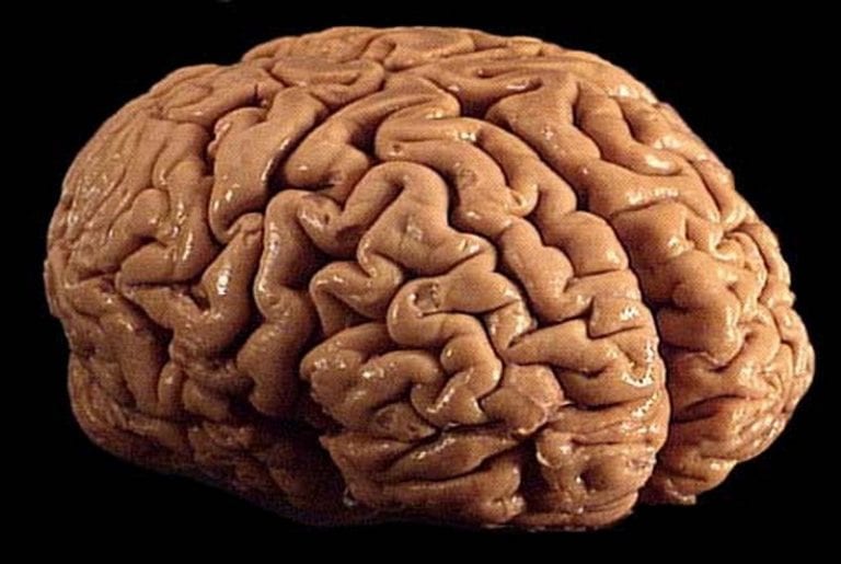 Science Explains Why Asians Have Bigger Brains Than Europeans and Africans