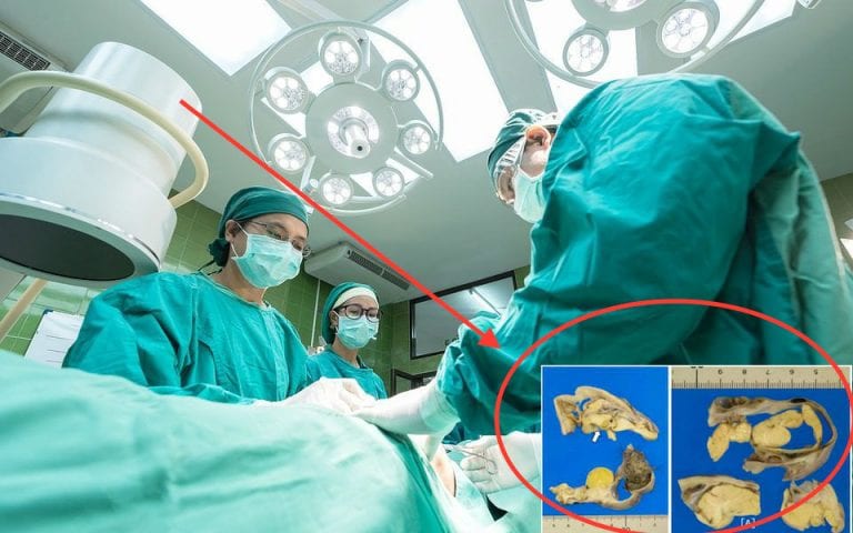 Surgeons Find ‘MONSTER’ Inside the Ovary of 16-Year-Old Japanese Girl