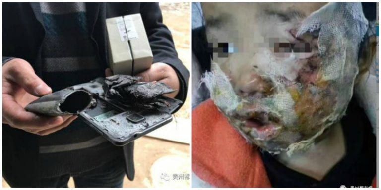 Samsung Phone Explodes on 5-Year-Old Girl’s Face in China