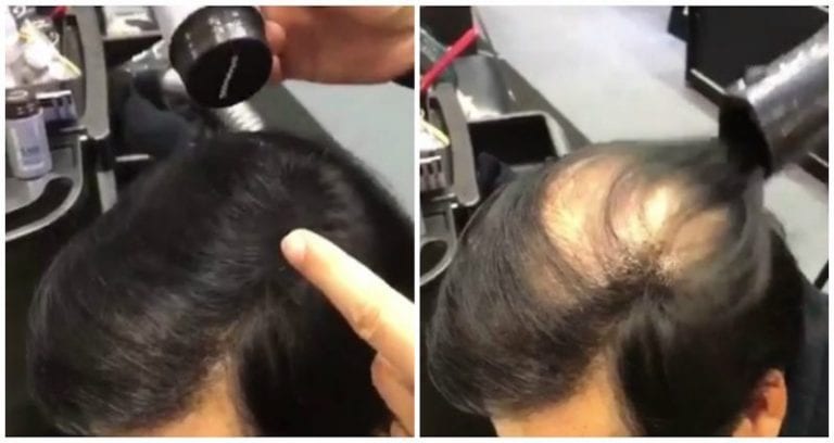 Japanese Twitter Goes Crazy Over Hair Product That Magically Covers Bald Spots