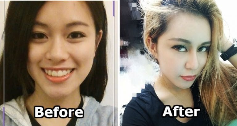 Hong Kong YouTuber Regrets Getting 30 Cosmetic Surgeries to Please Toxic Boyfriend