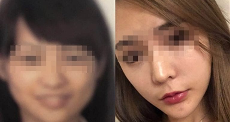 Woman Stopped From Boarding Plane When No One Can Recognize Her After Plastic Surgery