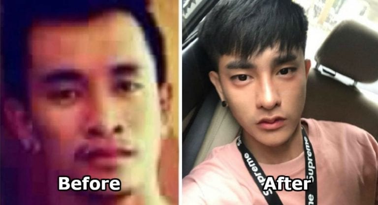 He Had 30 Plastic Surgeries to Become a ‘Korean’ Star in Thailand