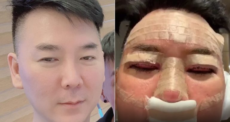 Celebrity in Singapore Plans to Sue South Korean Clinic for Botched Plastic Surgery
