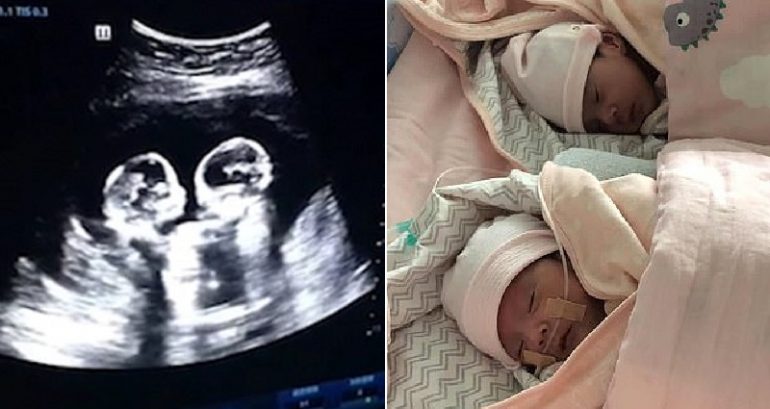 Ultra-sound Footage Shows Chinese Twin Sisters Literally Fighting Since They Were in the Womb