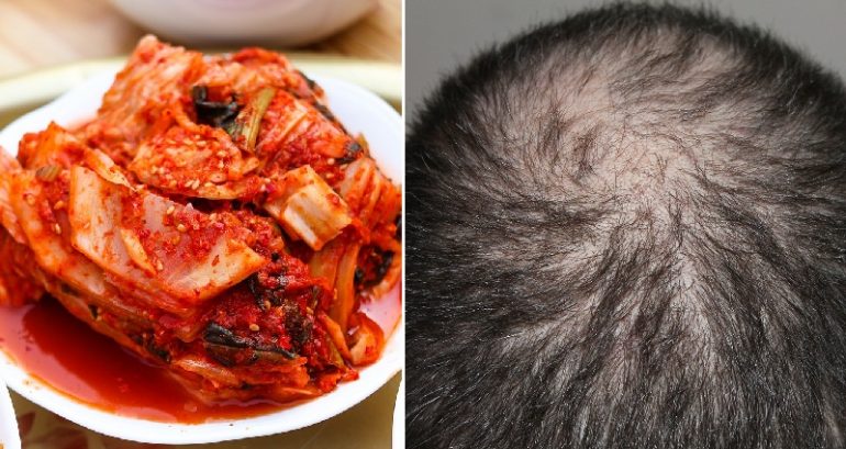 Kimchi Juice Has Been Found to Reverse Hair Loss, Scientists Claim