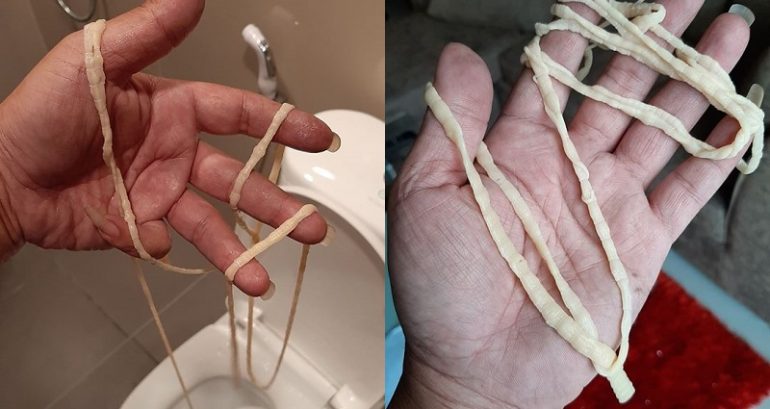 Thai Man Pulls 32-Foot Long Tapeworm From His Butt After Going to the Bathroom
