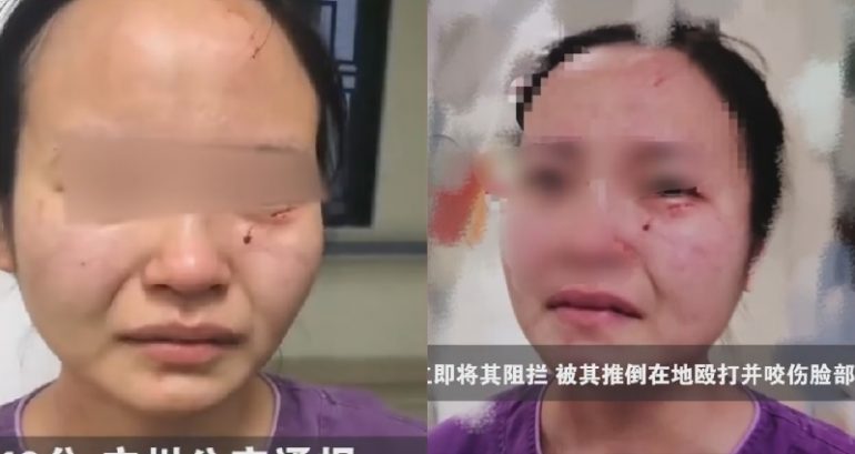 COVID-19 Patient Who Bit Nurse’s Face to Be Charged After Recovery in China
