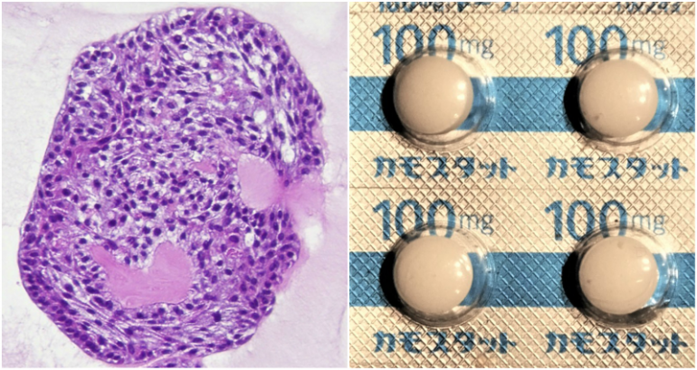 Japan Grows Mini Bronchi to Test COVID-19 Drug