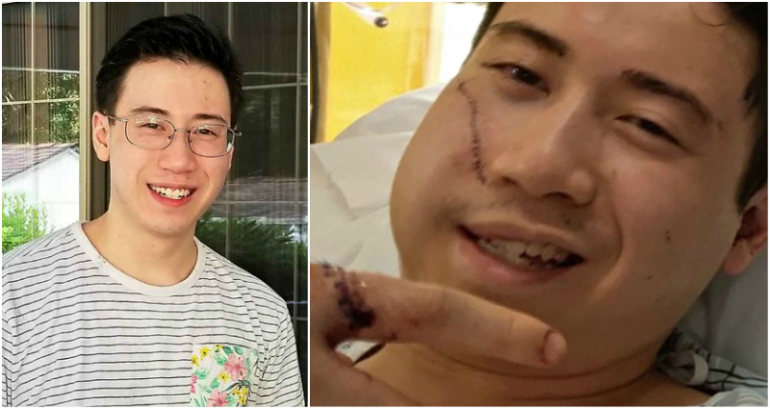 New Jersey Man Stabbed in the Head Protecting Friend From Violent Ex-Boyfriend