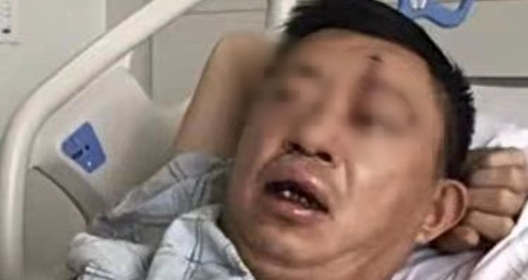 UPDATED: NYC Man Who Lost Teeth, Suffered Brain Hemorrhage After ‘Beating’ was Actually Injured After Drinking