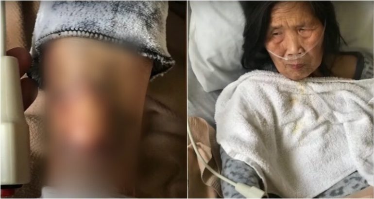 Family Accuses Bay Area Nursing Facility of Hitting 87-Year-Old Grandma