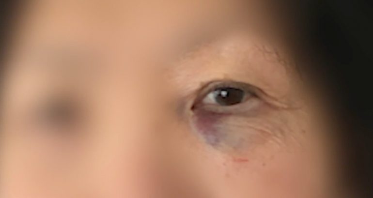 Asian American woman, 70, punched in the face in unprovoked Boston Chinatown attack