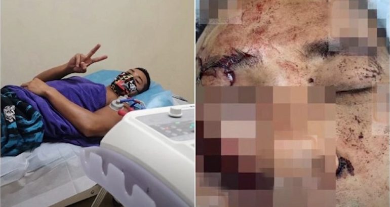 Hong Kong actor Jason Wong says his eyeballs were ‘nearly chopped off’ during knife attack in China