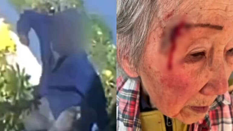 91-year-old woman with dementia punched, knocked into concrete in SF attack