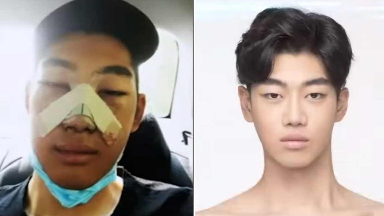 More South Korean Men Are Having Plastic Surgery To Look Pretty Like K Drama Actors