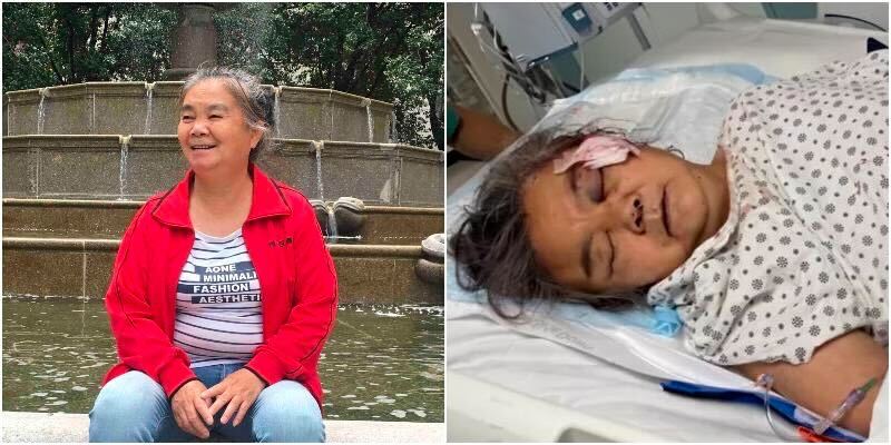 Elderly Asian woman’s head smashed with a ROCK in random NYC attack