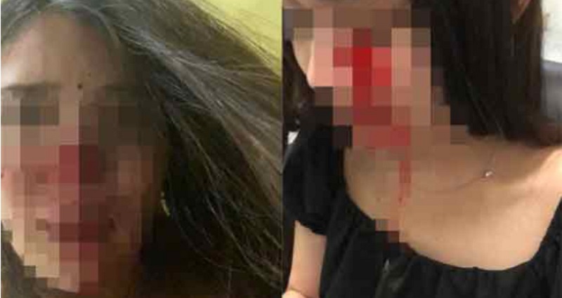 Thai Woman Attacked